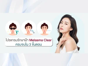 โปรแกรมรักษาฝ้า