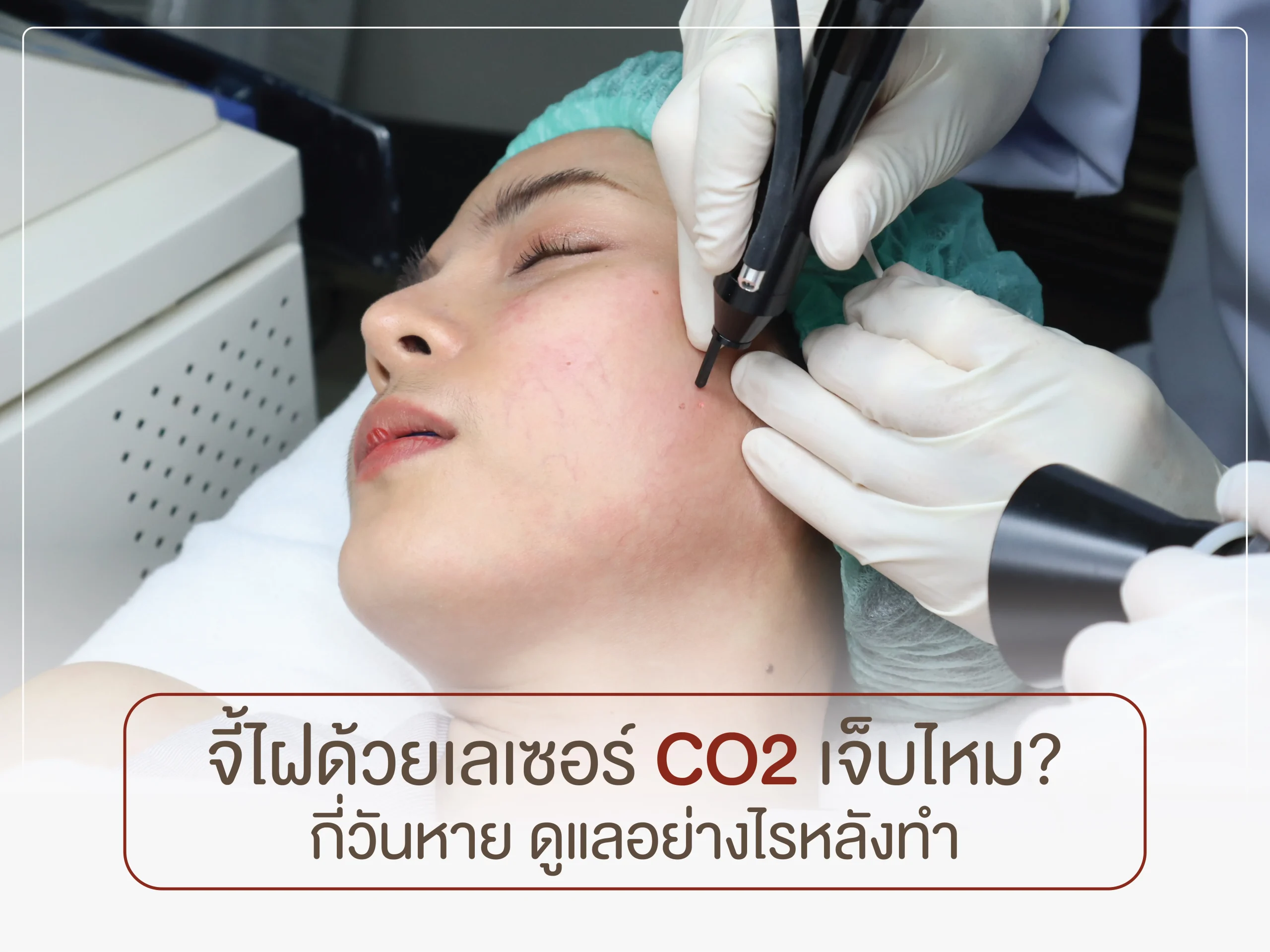 จี้ไฝด้วยเลเซอร์ CO2