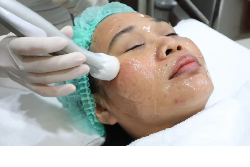 ทรีตเมนต์หน้าใส ฟื้นฟูผิวหลังเลเซอร์ฝ้า