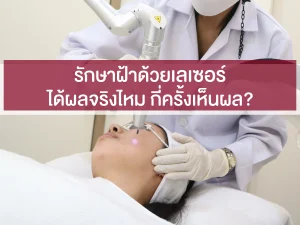 รักษาฝ้าด้วยเลเซอร์