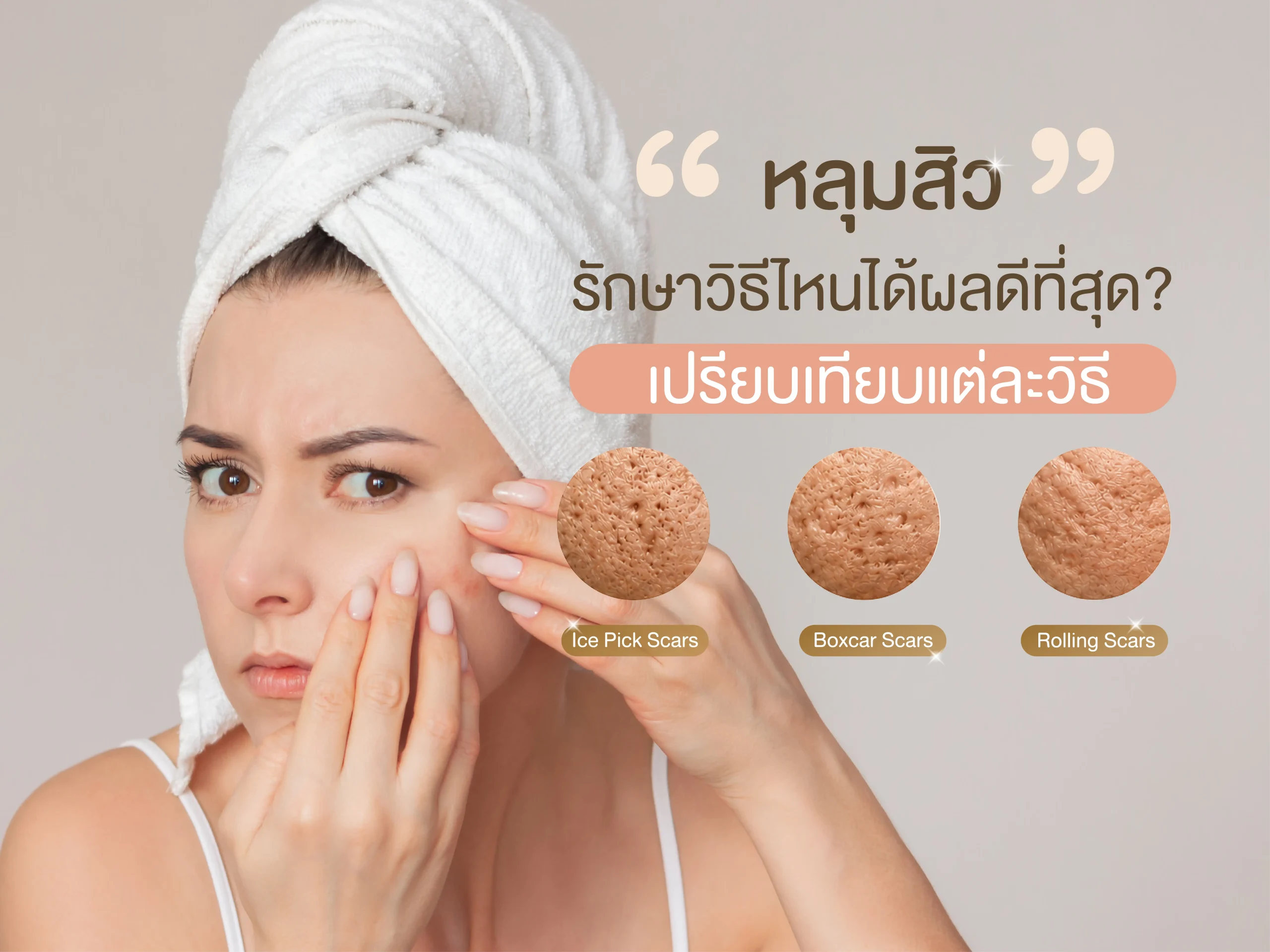 หลุมสิว รักษา