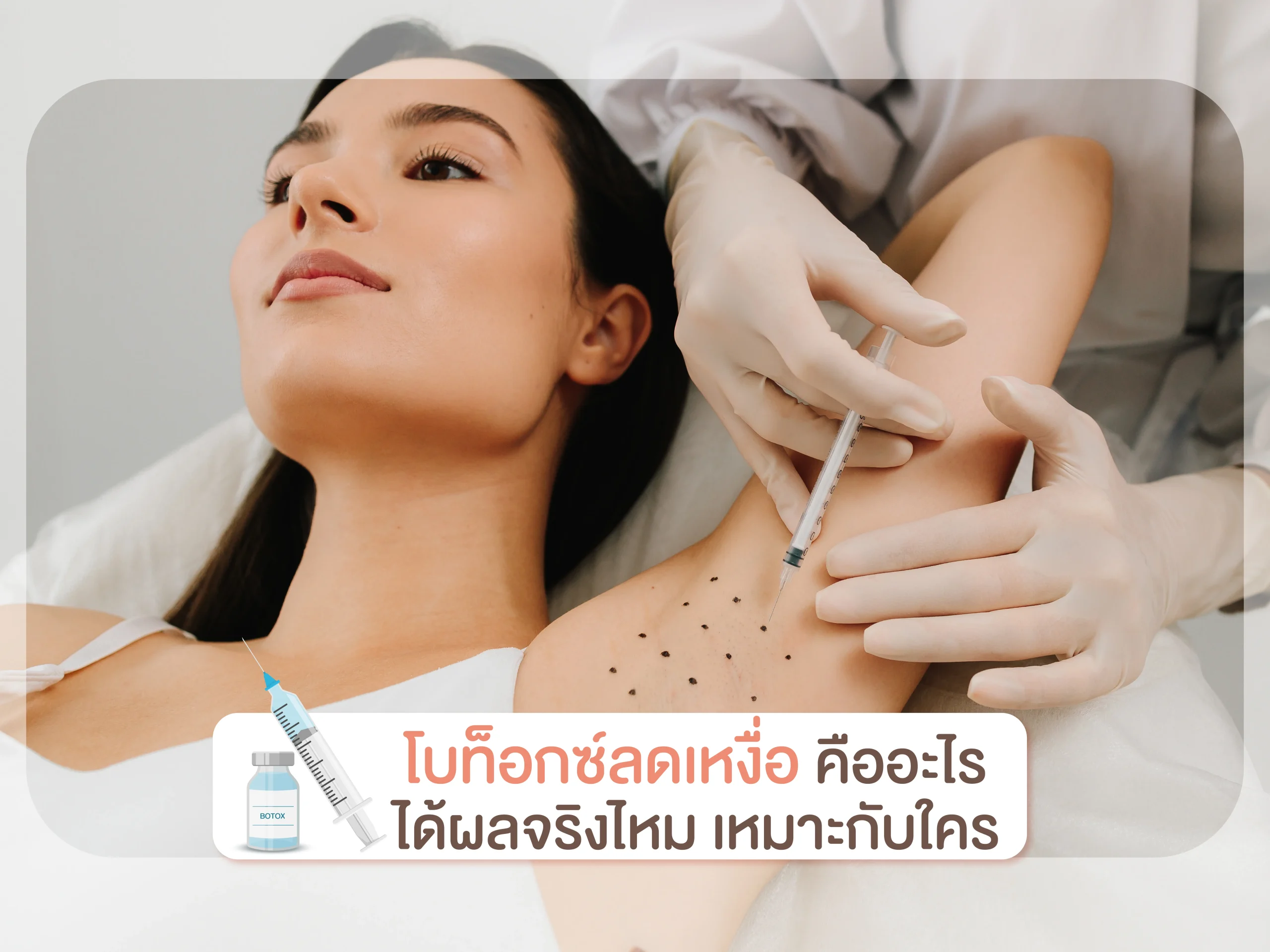 โบท็อกซ์ลดเหงื่อ
