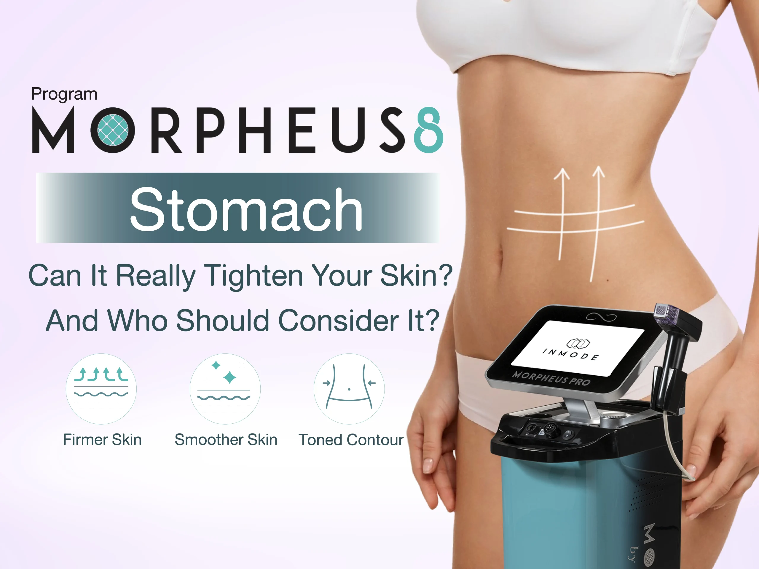Morpheus 8 Stomach