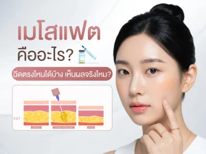 เมโสแฟต