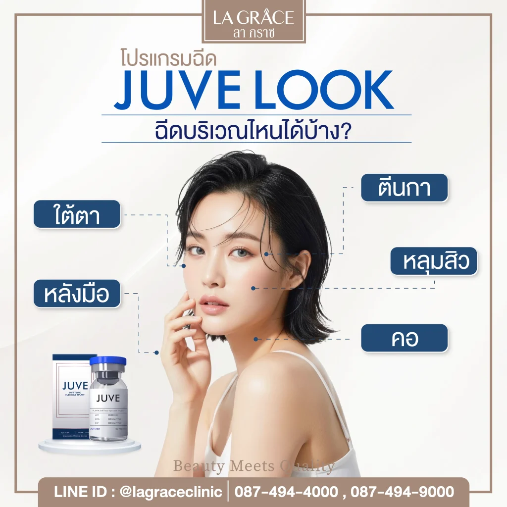 Juvelook ฉีดตรงไหนได้บ้าง 