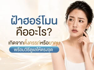 ฝ้าฮอร์โมน คืออะไร