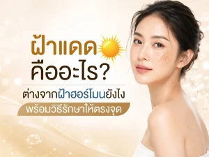 ฝ้าแดด คืออะไร