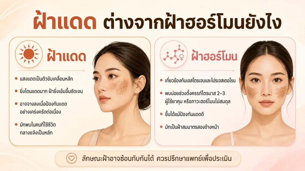 ฝ้าแดด ต่างจากฝ้าฮอร์โมนยังไง เปรียบเทียบสาเหตุและลักษณะฝ้า