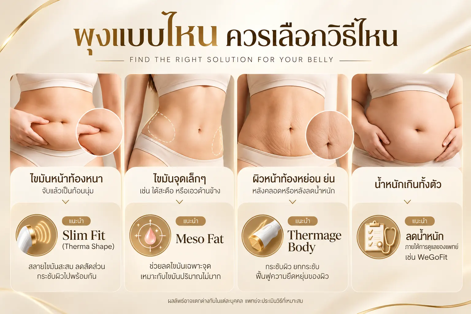 ลดพุง แบบไม่ผ่าตัด พุงแบบไหน ควรเลือกวิธีไหน
