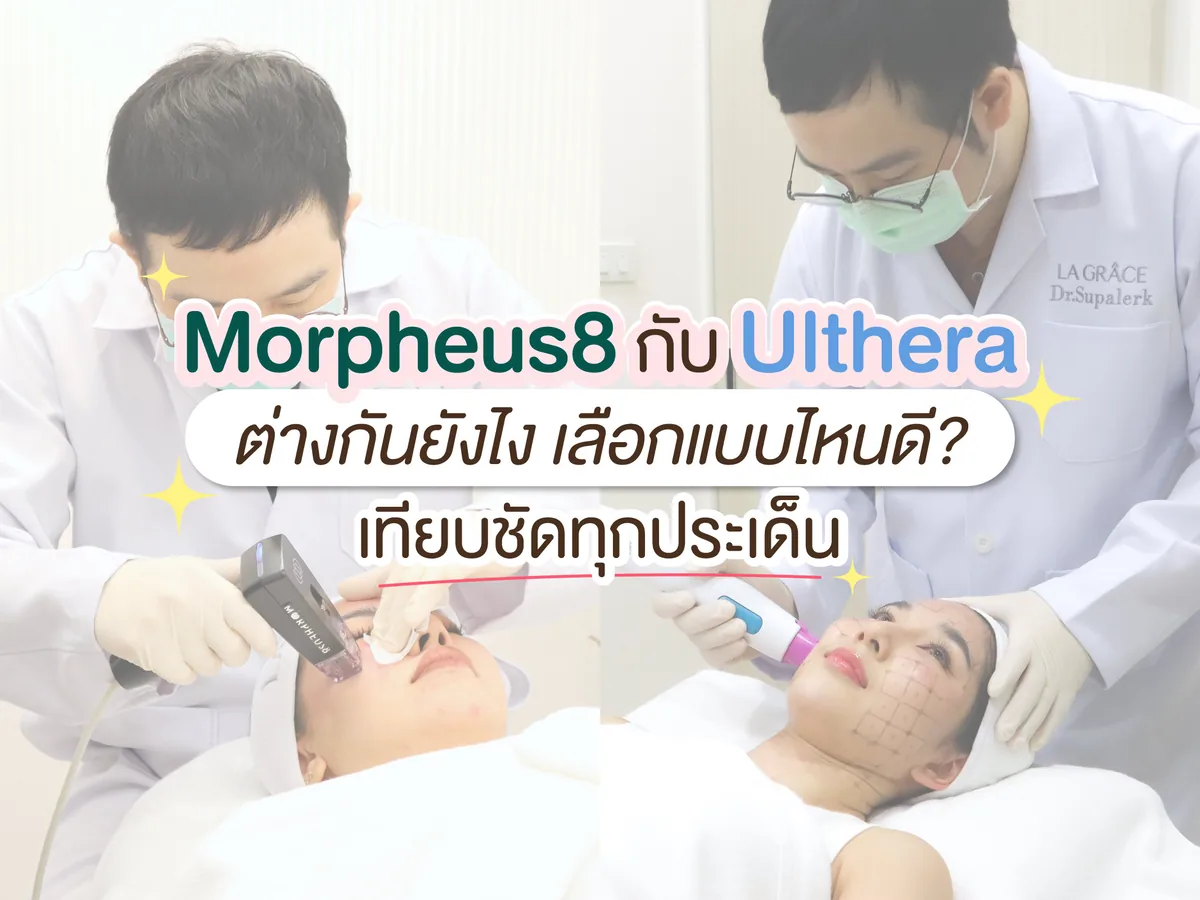 Morpheus8 กับ Ulthera ต่างกันยังไง เลือกแบบไหนดี